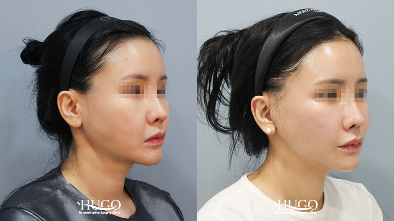 45도