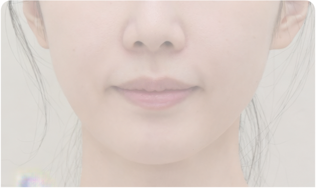 넓은 이마로 길어 보이는 얼굴