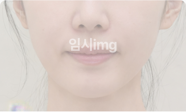 목거상술 전 턱선과 목선