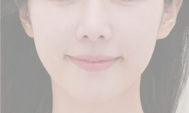 수술 후 예시 1