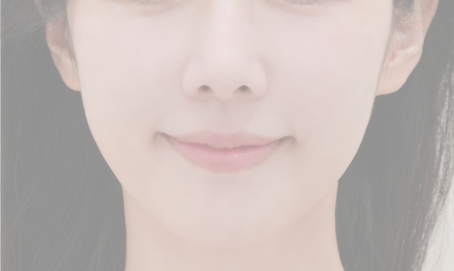 수술 후 예시 2