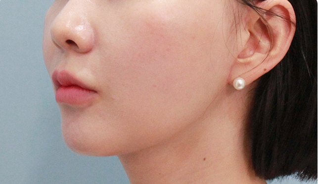 첫 번째 수술 후